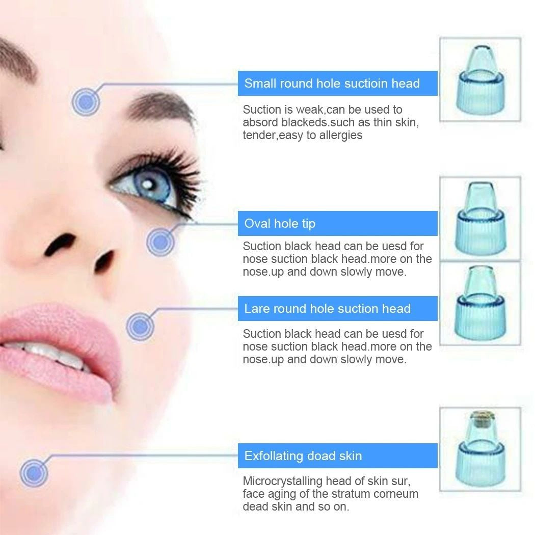 4-in-1 Blackhead Remover Vacuum – Portable Pore Cleaner & Facial Derma Suction Machine