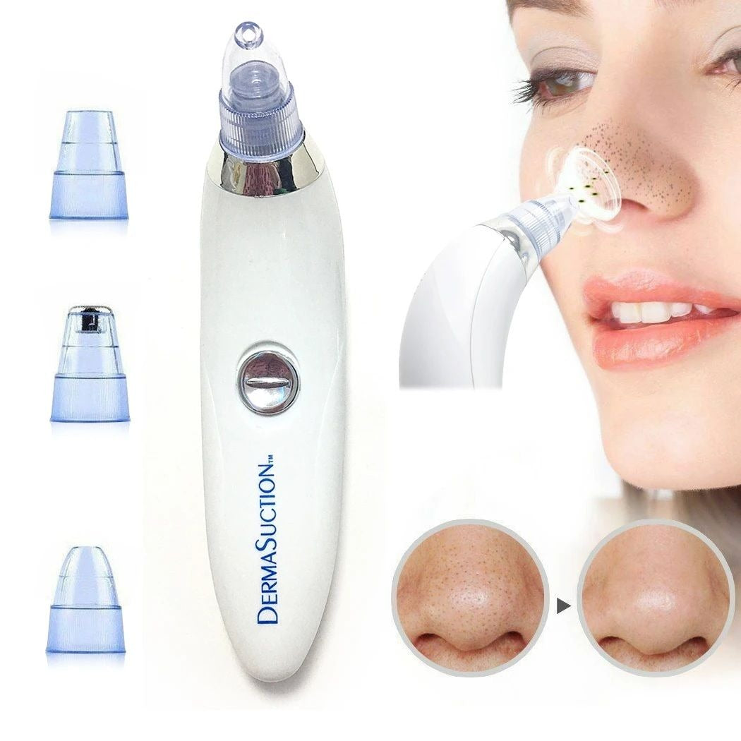 4-in-1 Blackhead Remover Vacuum – Portable Pore Cleaner & Facial Derma Suction Machine